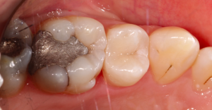 Screen Shot 2015-04-01 at 15.38.35