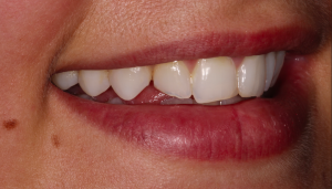 Screen Shot 2015-04-01 at 15.43.50